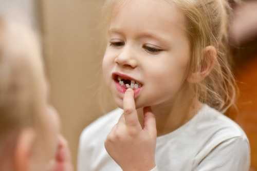 什么是氟斑牙？它的病因是什么？