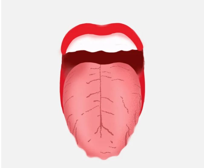 舌头裂口怎么办？
