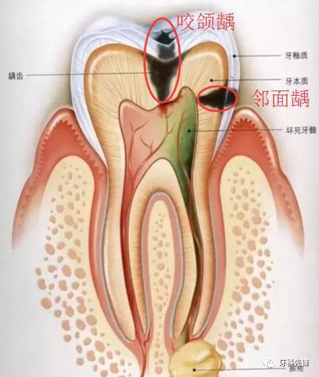 各种类型牙痛的用药技巧