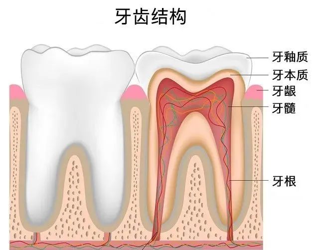 一顆蛀牙如果唔即刻補，等佢嘅命運將會係咩？