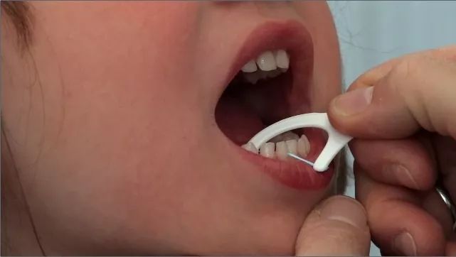 美国儿童牙医协会：父母要帮孩子刷牙到7岁！如何正确刷牙？