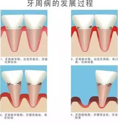 “徒手拔牙”！他们是怎么做到的？