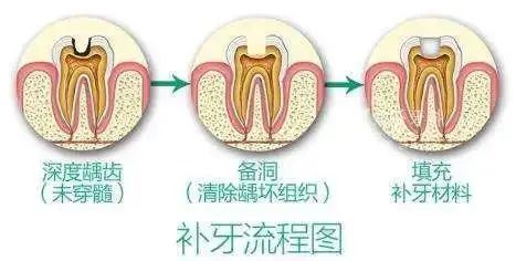 30多岁的小伙子因牙齿松动就诊结果全口牙齿都要拔掉……