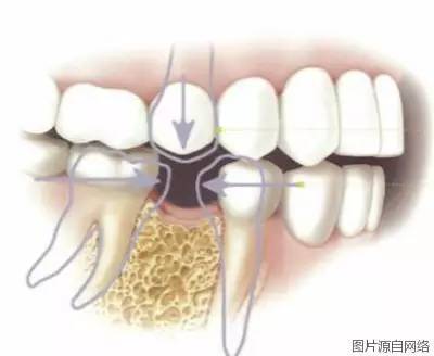 掉牙拔牙之后就不管它了后果竟然这么严重？！