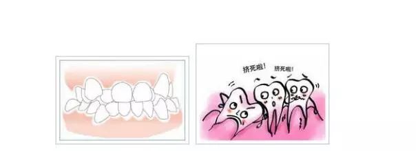 牙齿对脸型的影响到底有多大？