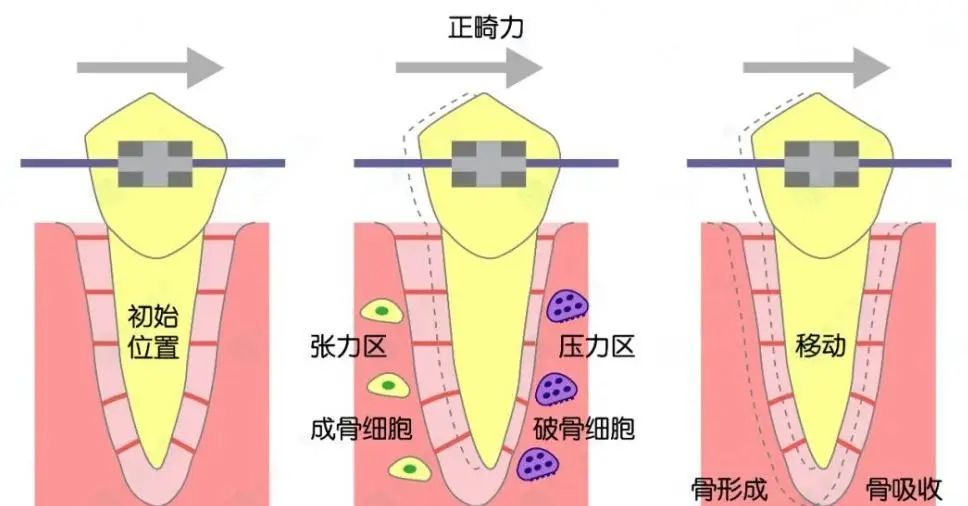 30岁整牙会不会太晚？