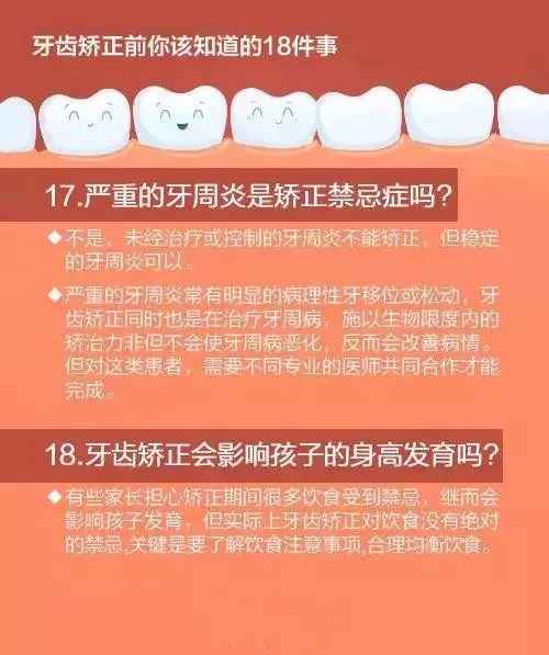 牙齿矫正前必须知道的18件事！