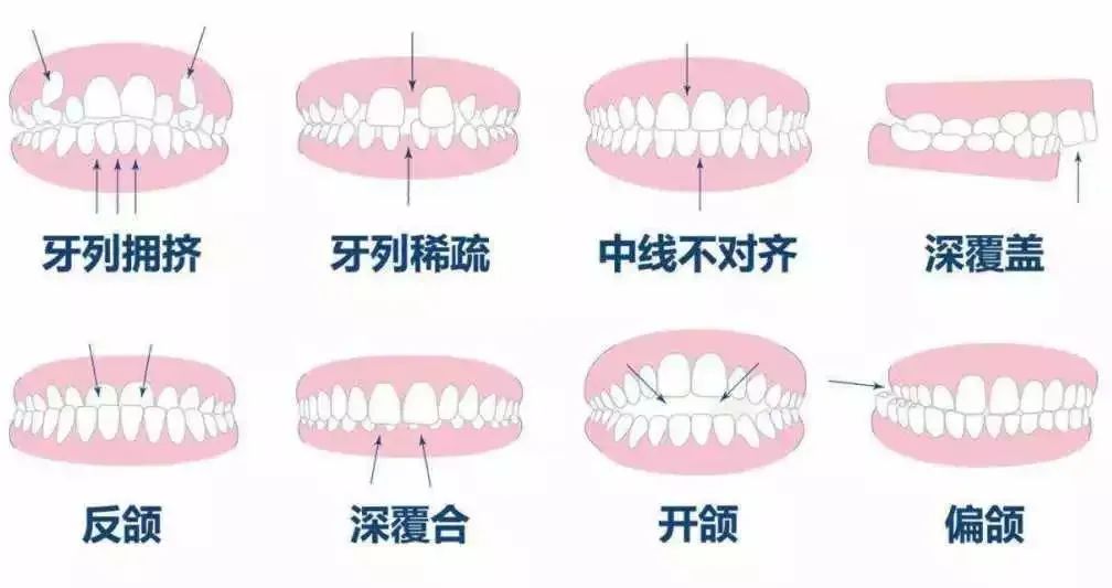 牙齿健康的四个标準，你知道吗？