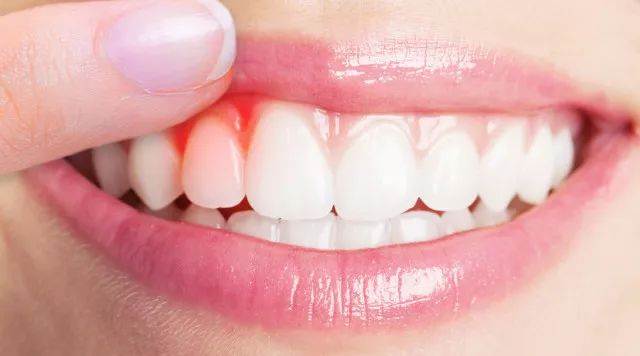 牙齿痠软无力是怎麼了？