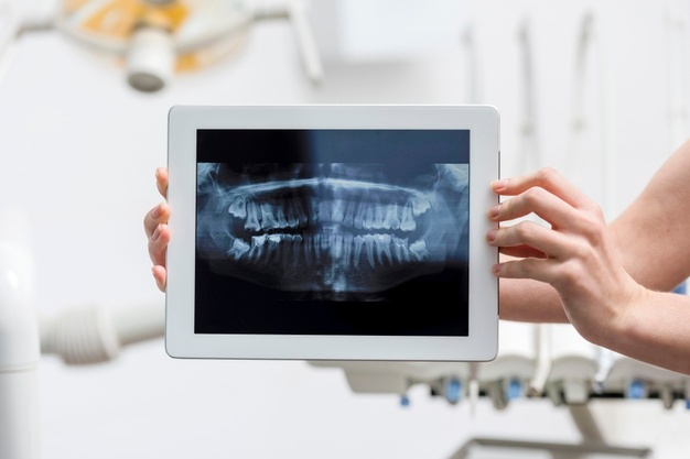 close-up-hands-holding-tablet-with-x-ray_23-2148396226