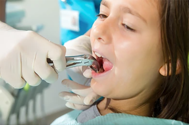 dentist-extracted-tooth-little-girl-260nw-231212857 dentist-extracted-tooth-little-girl-260nw-231212857