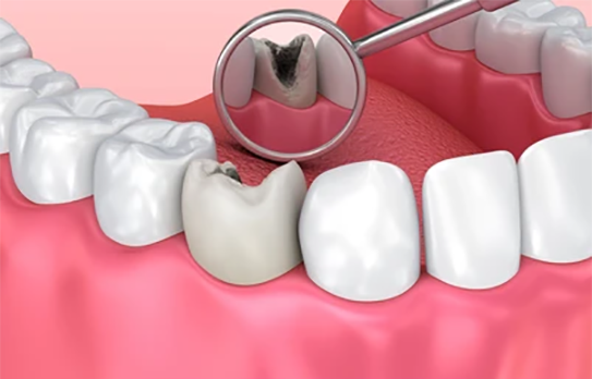 teeth-260nw-658131736