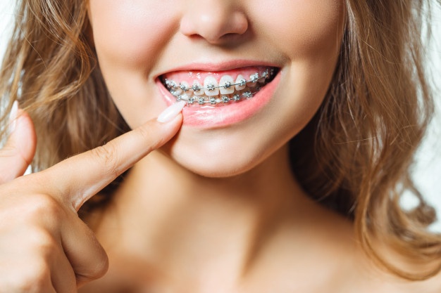 close-up-portrait-young-cheerful-readhead-woman-orthodontist_168410-400