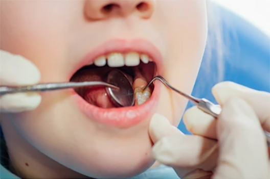 healthy-teeth-mouth-child-course-260nw-263390645