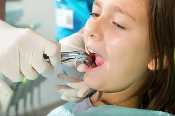 dentist-extracted-tooth-little-girl-260nw-231212857