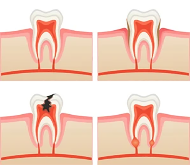 toothache-260nw-67141300
