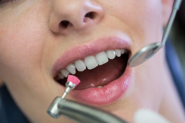 dentist-examining-female-patient-with-tools_107420-74185