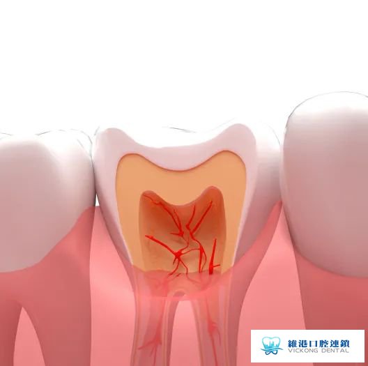 牙疼