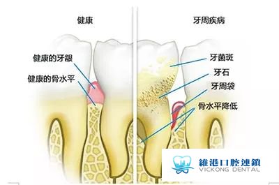 undefined 保持口腔健康
