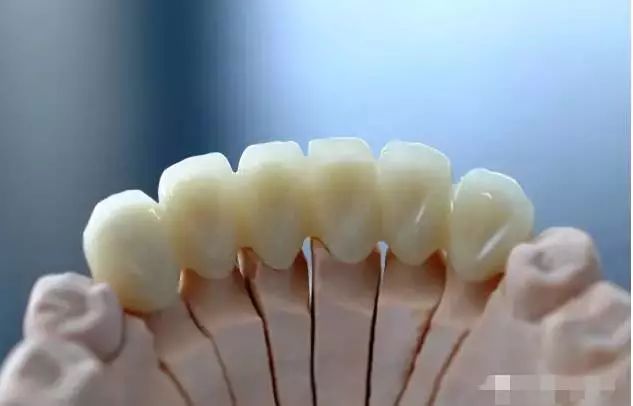 氧化锆全瓷牙