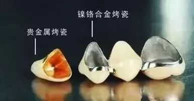 珠海镶牙哪里好