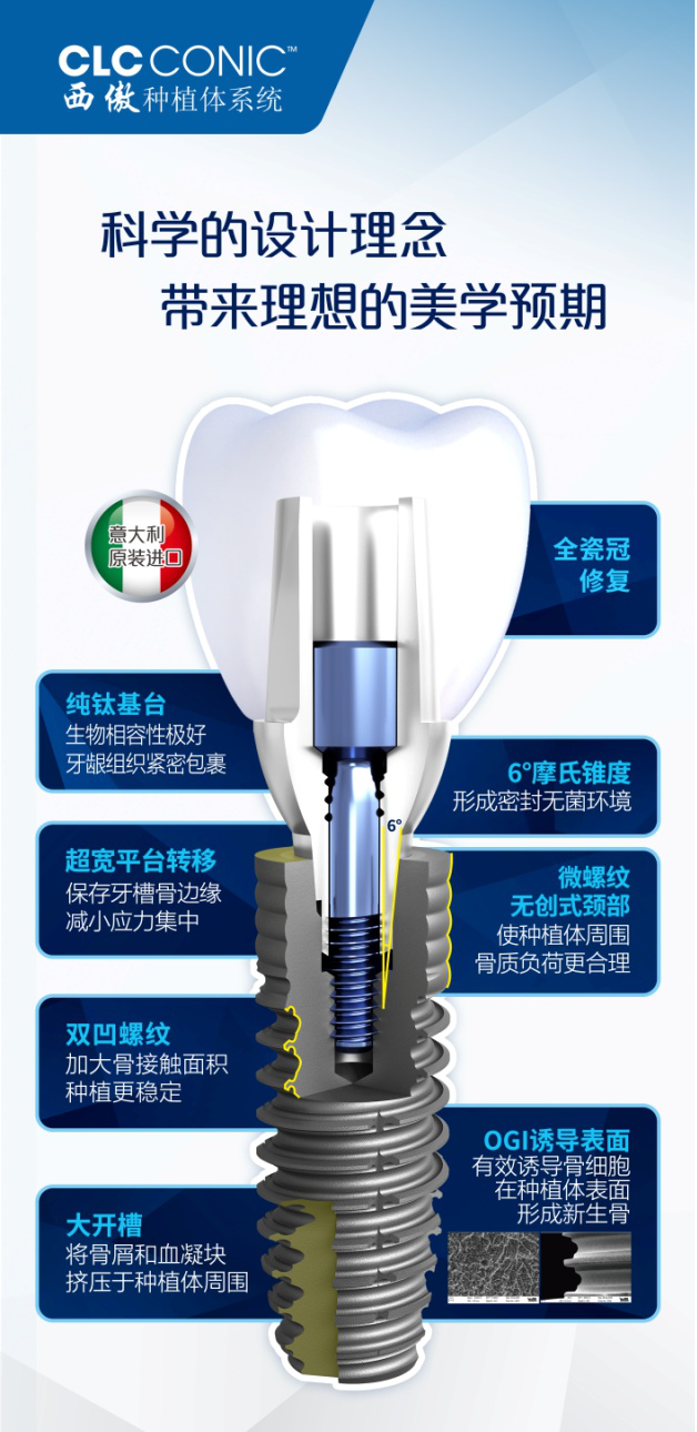 新品牌—维港口腔连锁引进意大利高端种植品牌