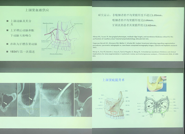 维港口腔种植牙医师受邀参加登腾高级专家研讨会