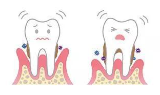 牙周疾病，牙齿鬆动